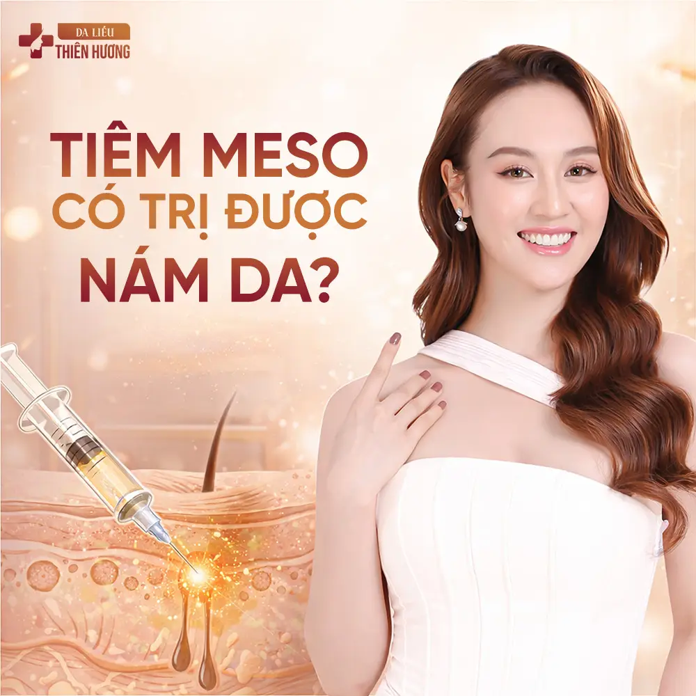 Tiêm Meso Trị Nám: Hiệu Quả, Ai Phù Hợp & Khi Nào Nên Làm?