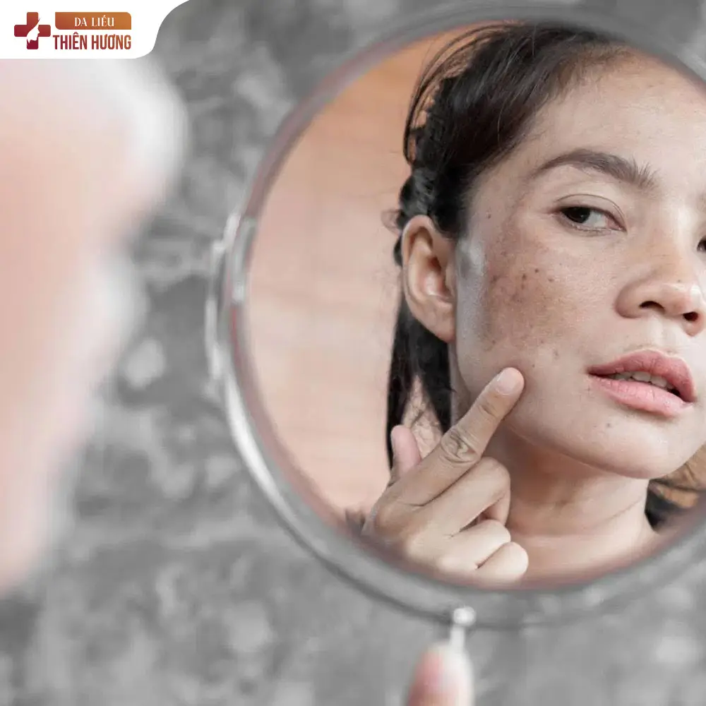 Tinh Bột Nghệ Trị Nám: Công Dụng Thực Tế Của Đắp Mặt Nạ Và Uống Nghệ Theo Nghiên Cứu Khoa Học