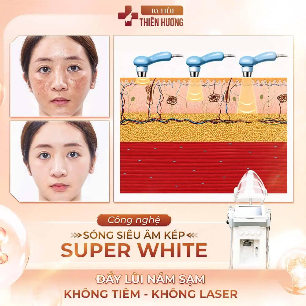 Trị nám da bao nhiêu tiền? Bảng giá trị nám tại TP.HCM
