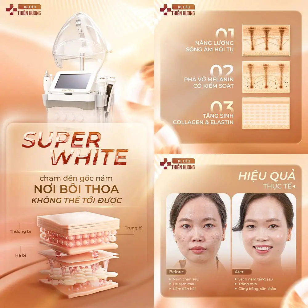 Trị nám da bao nhiêu tiền? Bảng giá trị nám tại TP.HCM