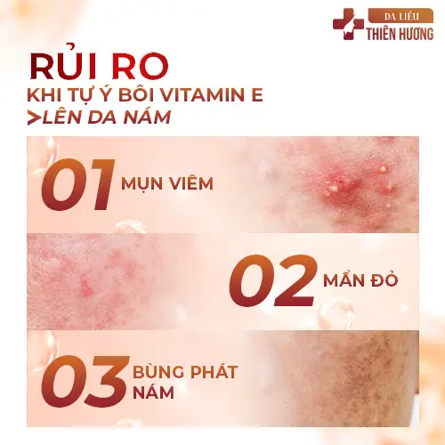 Vitamin E Trị Nám Được Không? Sự Thật & Cách Dùng Đúng